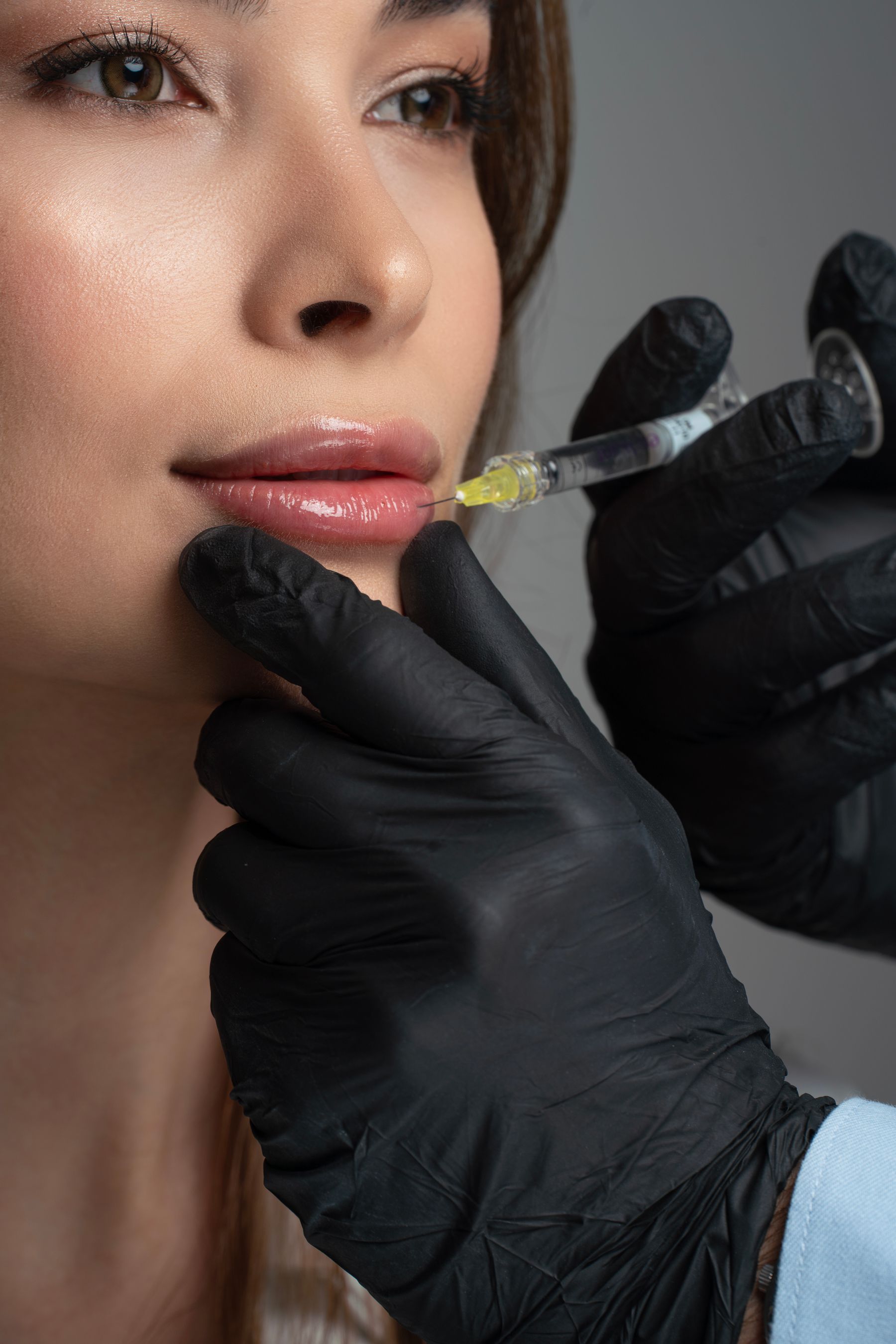 Bioestimuladores de colágeno — detalhe do atendimento