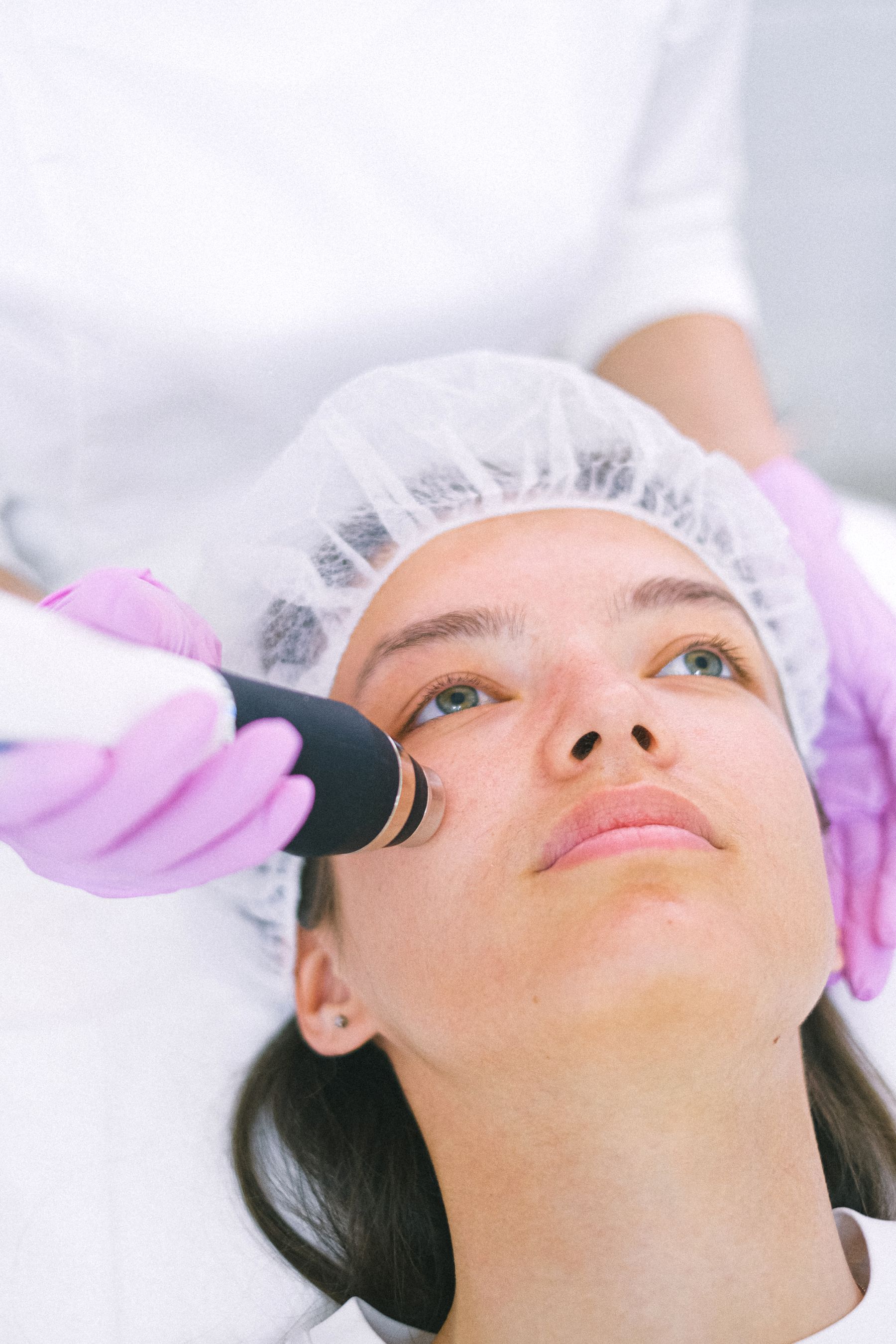 Microagulhamento na Lumière Estética